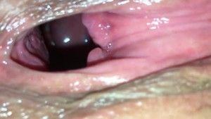 best of Dick cervix big